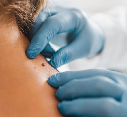 Quand consulter un dermatologue privé et comment préparer son rendez-vous