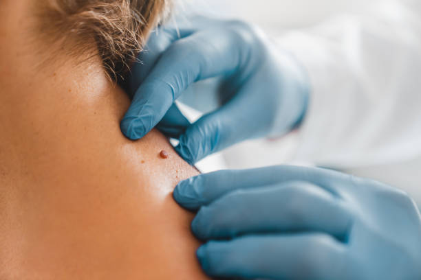 Quand consulter un dermatologue privé et comment préparer son rendez-vous