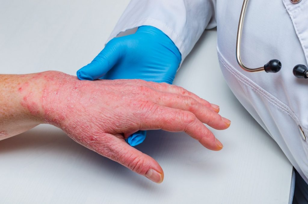 Dermatologie Médicale